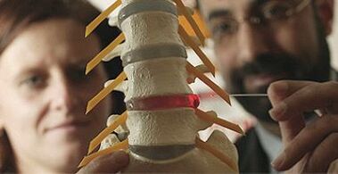 kajian osteochondrosis pada model tulang belakang