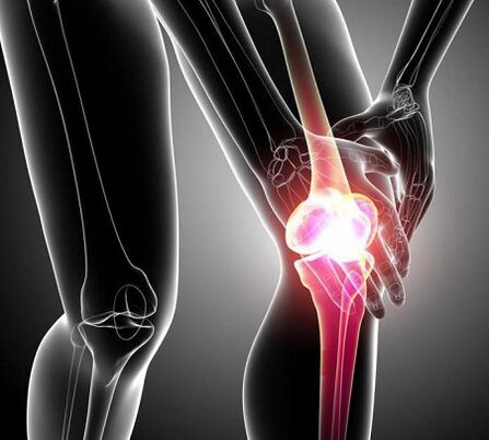 kerosakan pada sendi lutut dengan artritis dan arthrosis