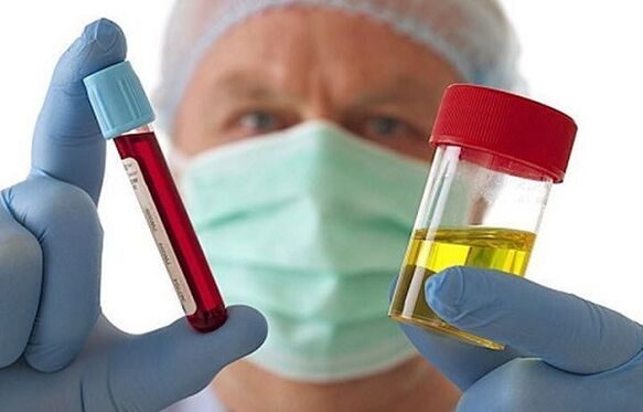 Cara untuk mendiagnosis osteochondrosis tulang belakang serviks