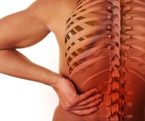 sakit belakang dengan osteochondrosis lumbar