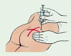 suntikan untuk rawatan osteochondrosis